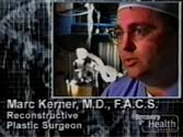 Dr Marc Kerner on Impact “Stories of Survival” - impact_kerner