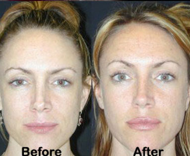 Nose Doctor in Los Angeles
